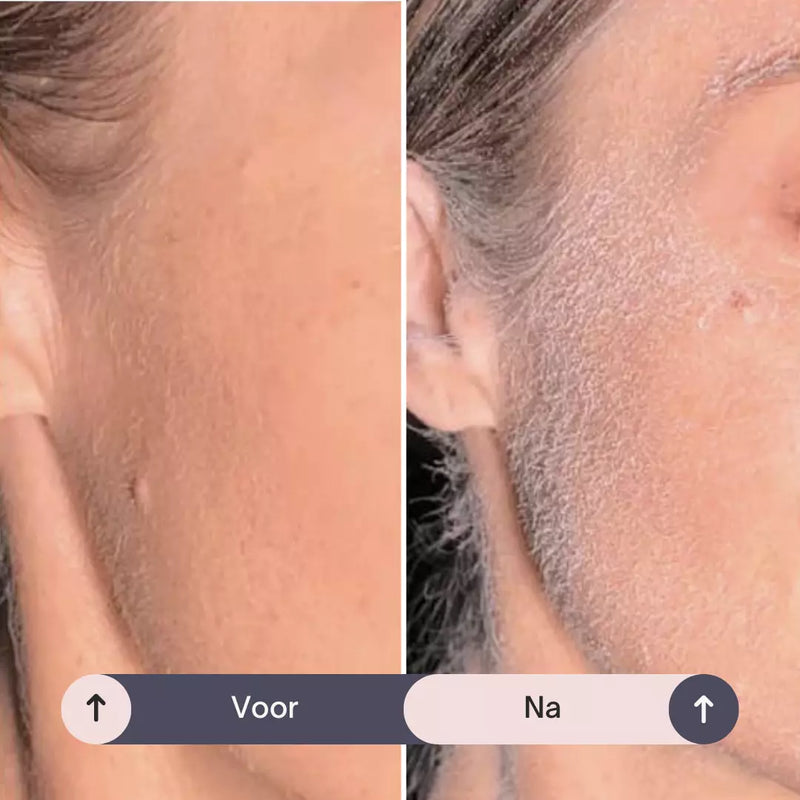 MagicSpray™ - Gezichtshaar Identificatie Spray